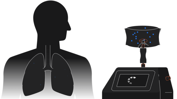Breath Diagnostics onboard new president and closes critical financing