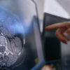 Median Technologies and European Investment Bank agrees to €37.5M loan